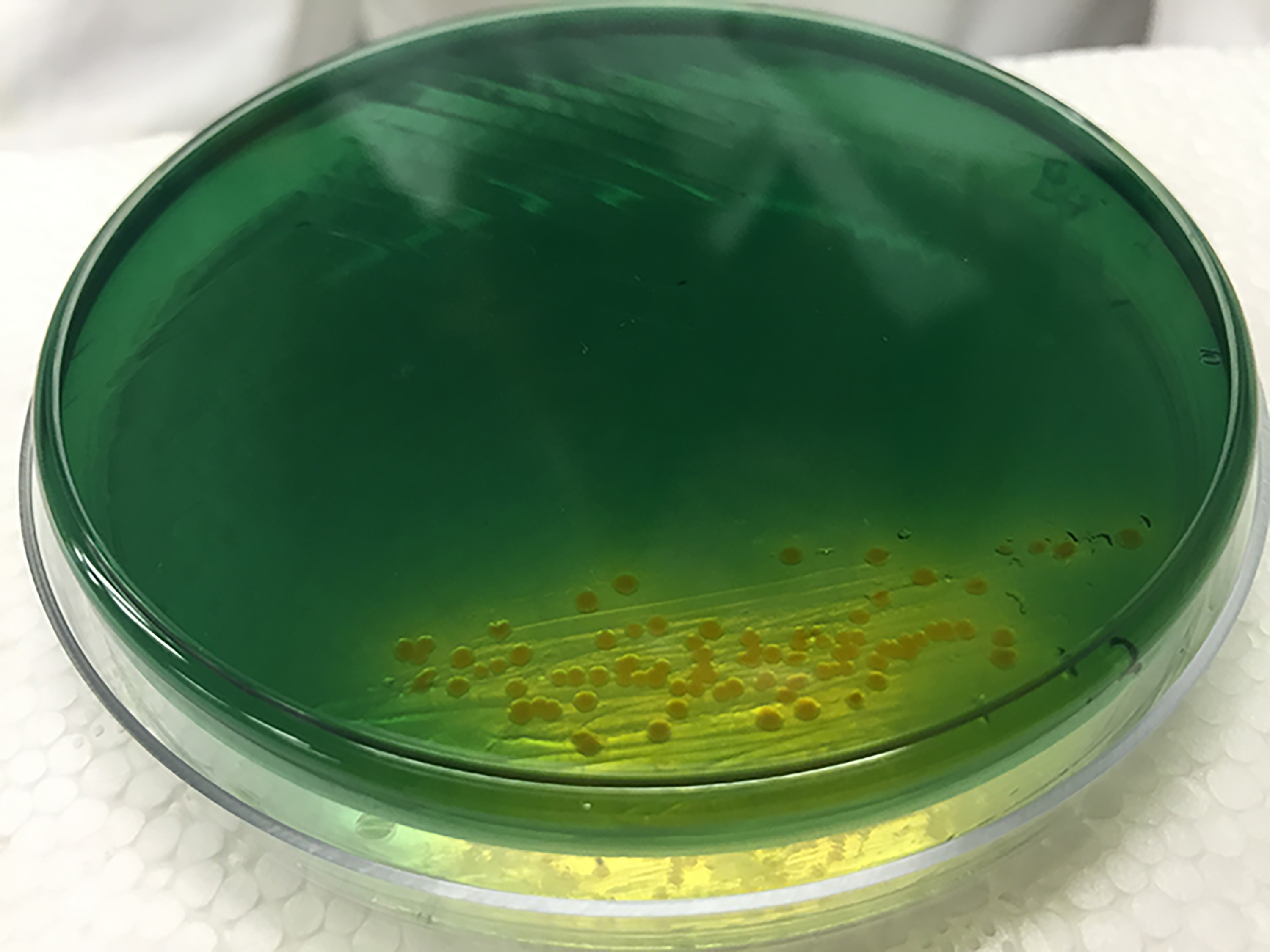 Cholera on Agar Plate2