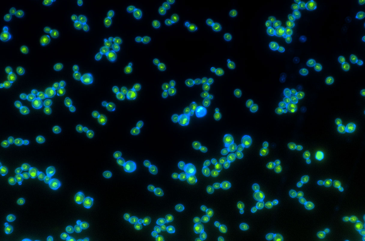 Green rhodopsin proteins inside the blue cell walls help these yeast grow faster when exposed to light. Photo: Anthony Burnetti, Georgia Institute of Technology.