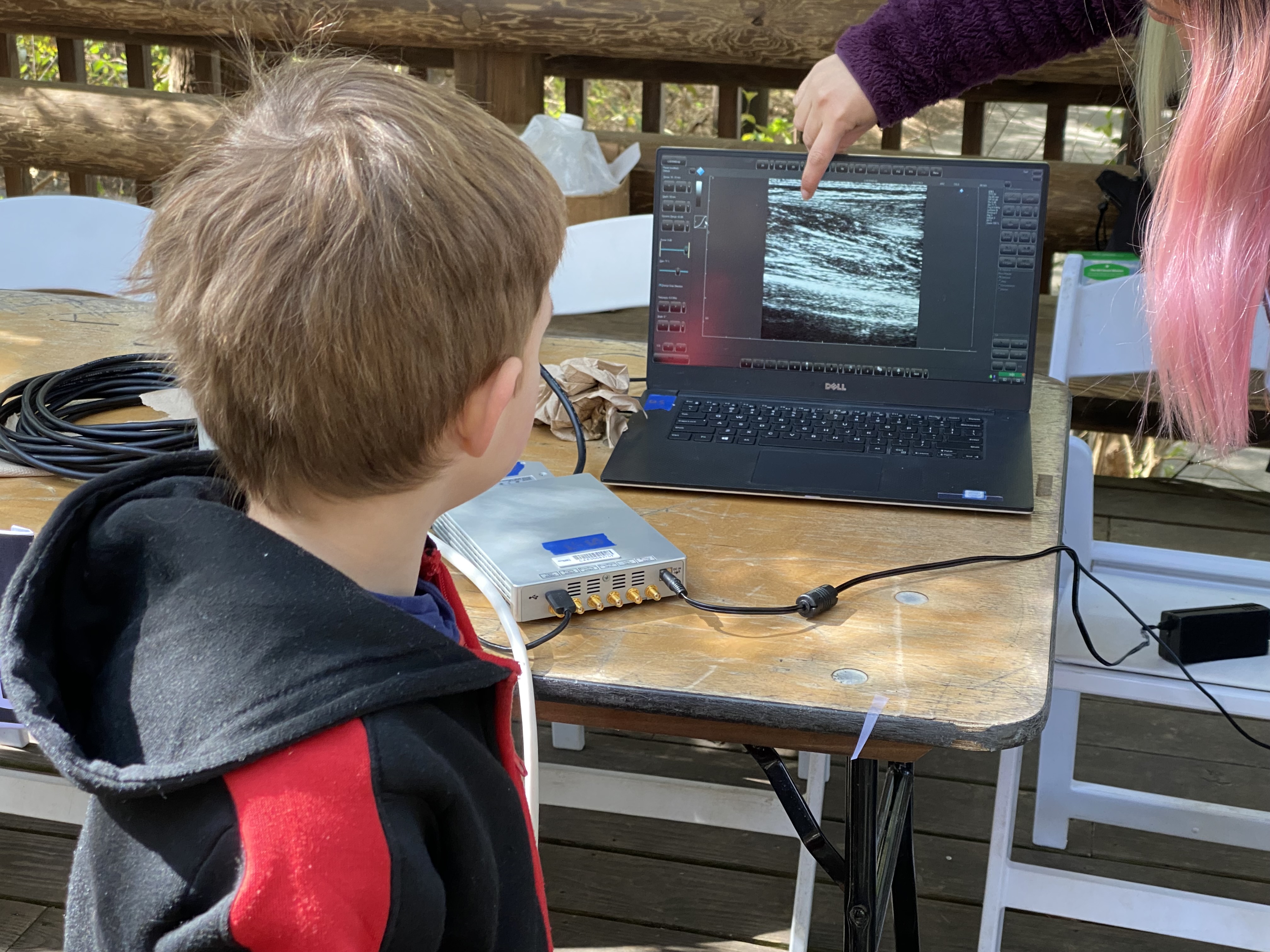 Wells Jackson, 6, watches an ultrasound image of his muscles at Zoo Atlanta during the Atlanta Science Festival. (Photo Renay San Miguel)