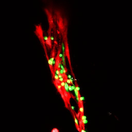 Injured muscle tissue with hydrogel delivered stem cells