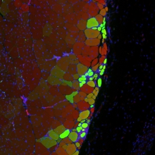 New muscle strands thanks to stem cell hydrogel