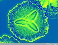 Periodontitis culprit Aggregatibacter actinomycetemcomitans by CC